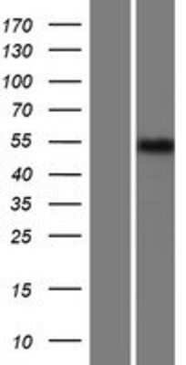 Western Blot: archaemetzincin-1 Overexpression Lysate [NBP2-05702]