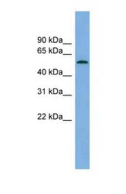 Western Blot: GLCCl1 Antibody [NBP1-70414]