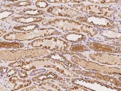 Immunohistochemistry-Paraffin: Ovastacin Antibody [NBP2-98076]