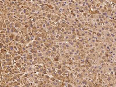 Immunohistochemistry-Paraffin: Ovastacin Antibody [NBP2-98076]