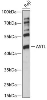 Western Blot: Ovastacin AntibodyAzide and BSA Free [NBP2-92092]