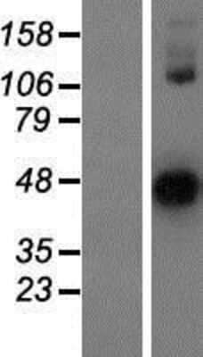 Western Blot: Ovastacin Overexpression Lysate [NBP2-10730]