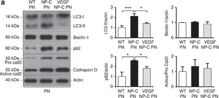Detection of Mouse Cathepsin D by Western Blot