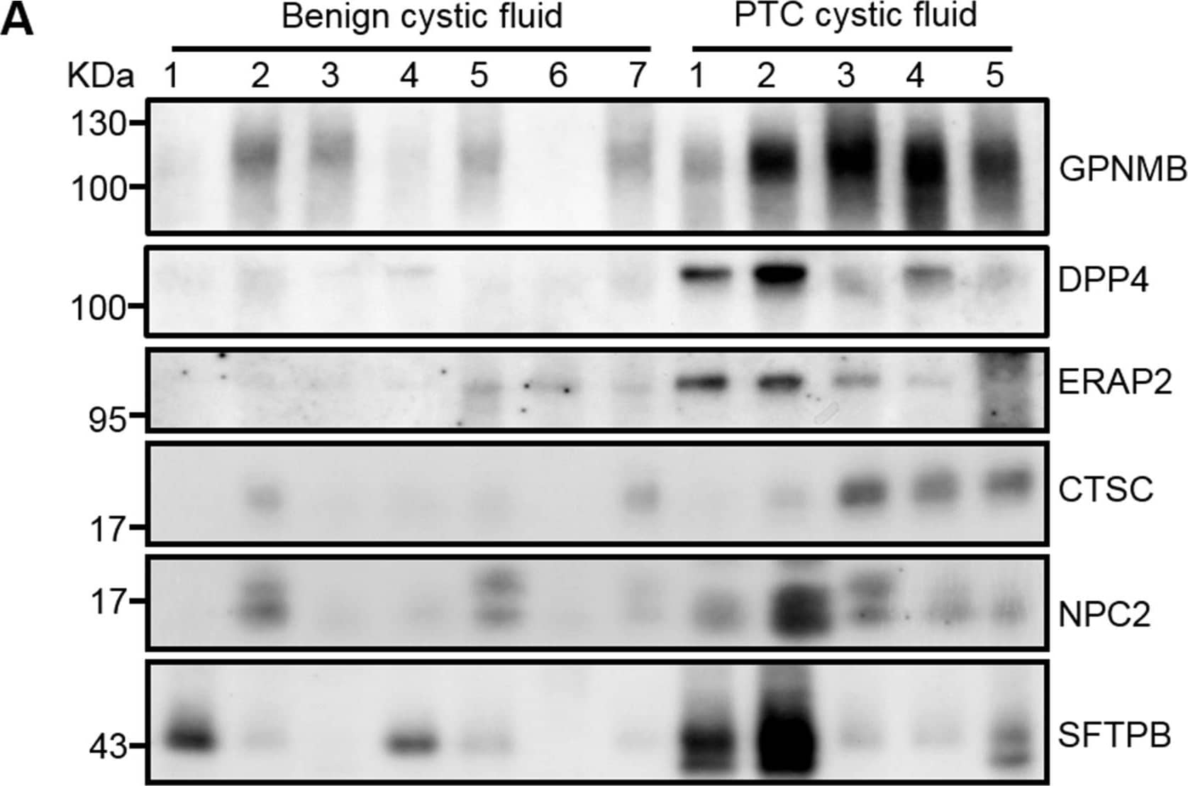 Detection of DPPIV/CD26 by Western Blot