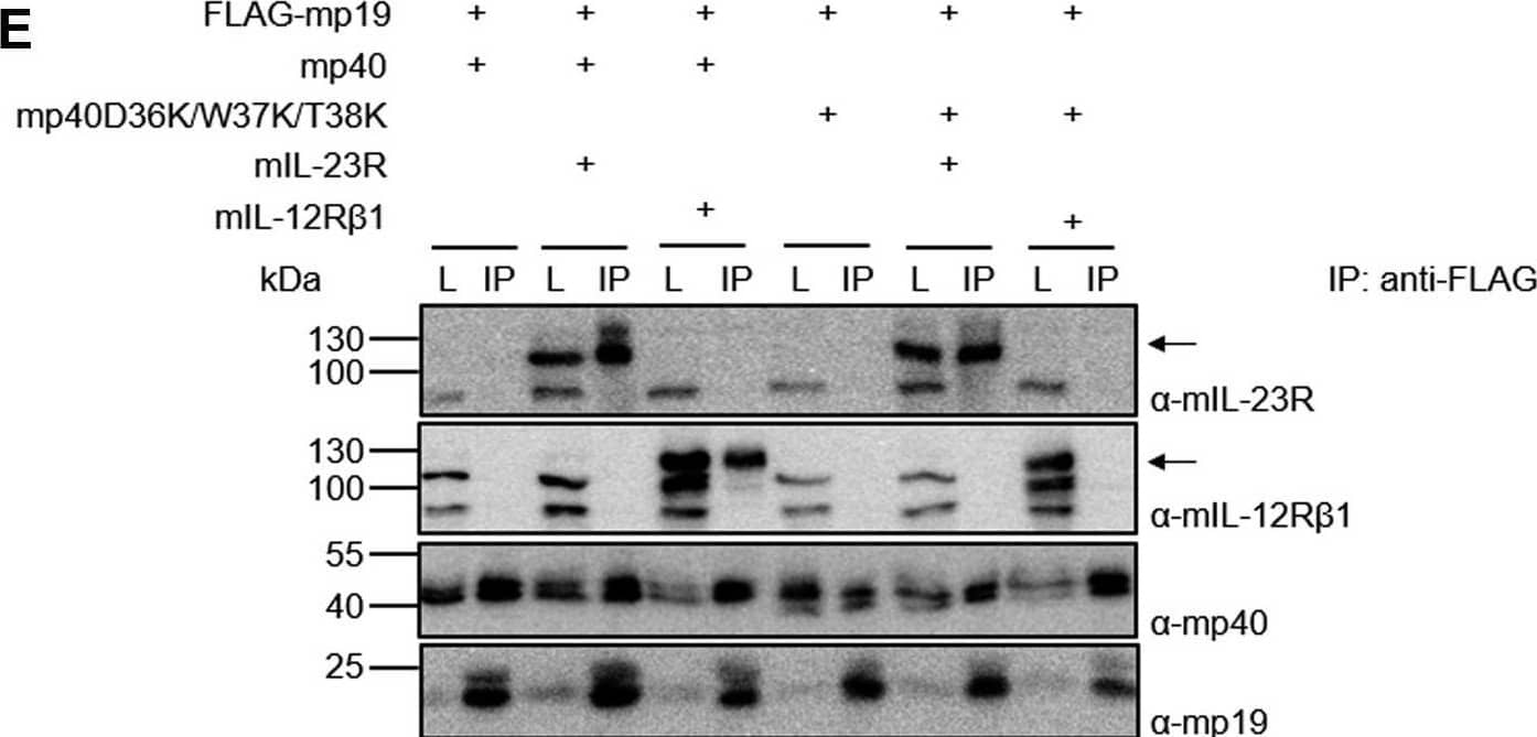 Detection of IL-12 R beta1 by Western Blot