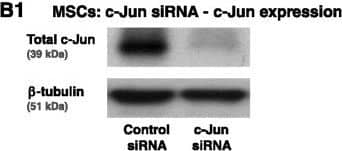 Detection of Human CXCL8/IL-8 by ELISA