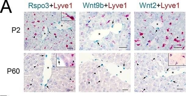Detection of Mouse LYVE-1 by Immunohistochemistry