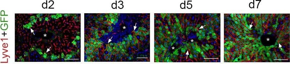Detection of Mouse LYVE-1 by Immunohistochemistry