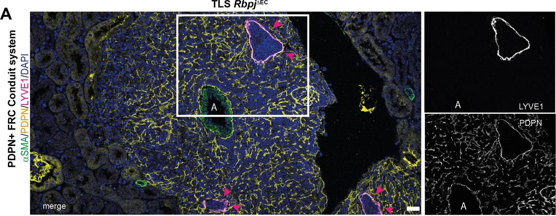 Detection of Mouse LYVE-1 by Immunohistochemistry