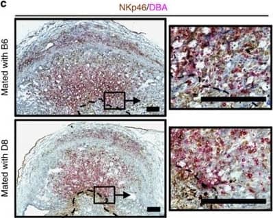 Detection of Mouse NKp46/NCR1 by Immunocytochemistry/Immunofluorescence