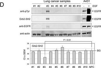 Detection of EGFR by Western Blot