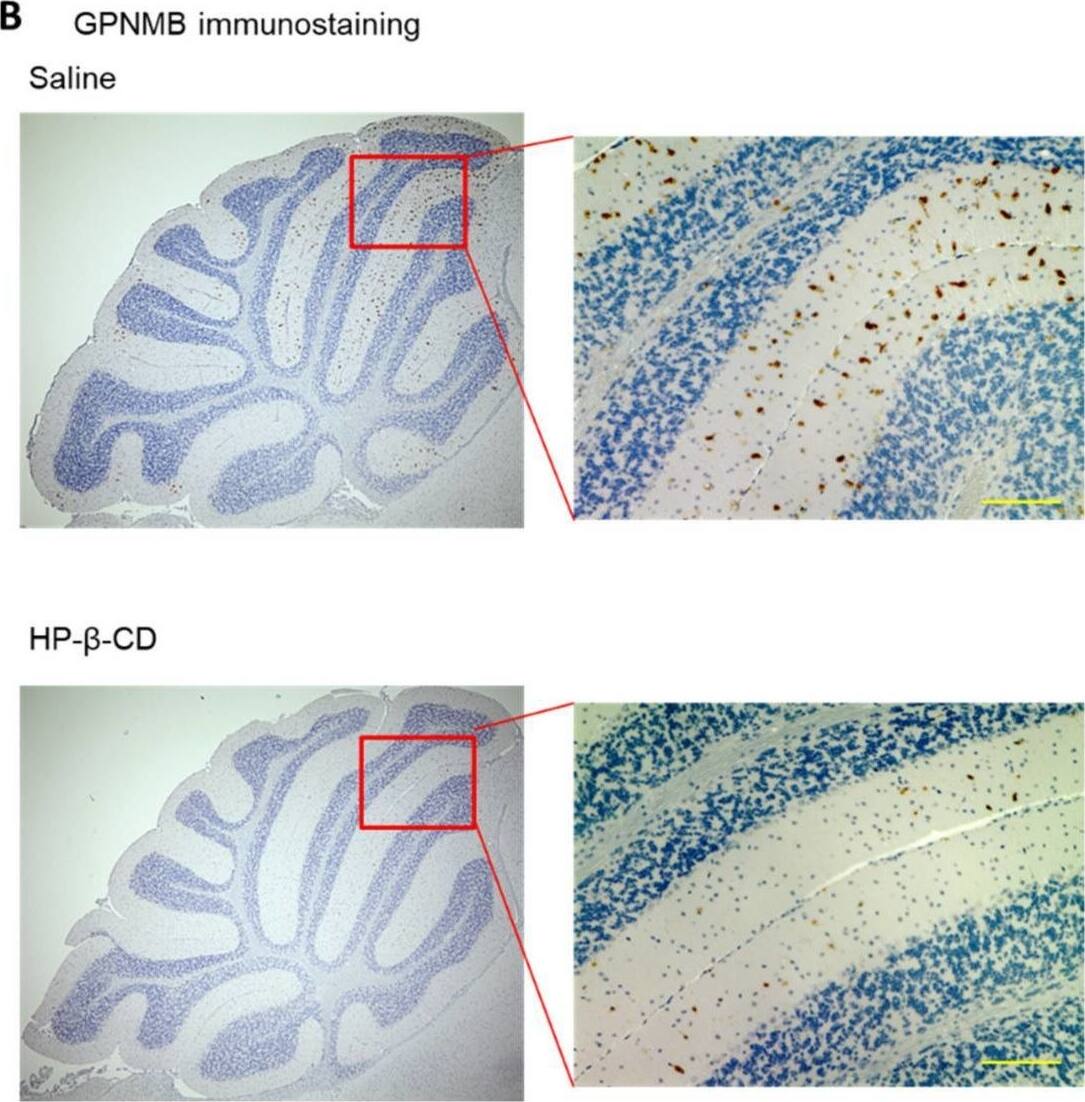 Detection of Osteoactivin/GPNMB by Immunohistochemistry