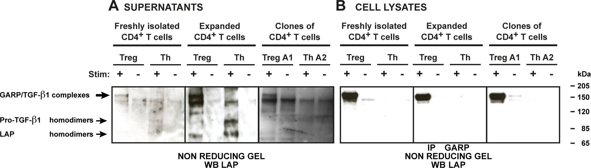 Detection of Human LAP (TGF-beta 1) by Western Blot