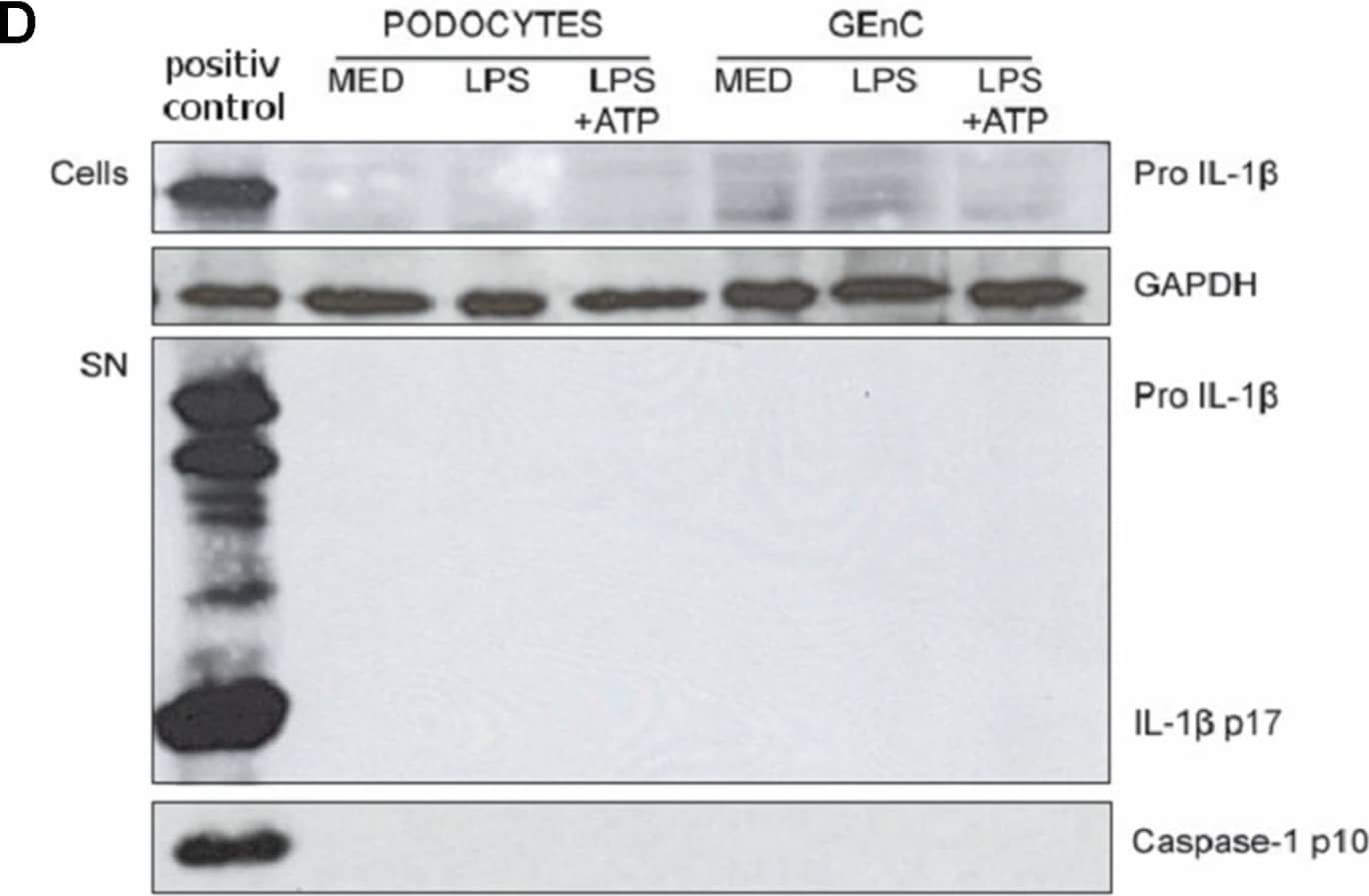 Detection of IL-1 beta/IL-1F2 by Western Blot