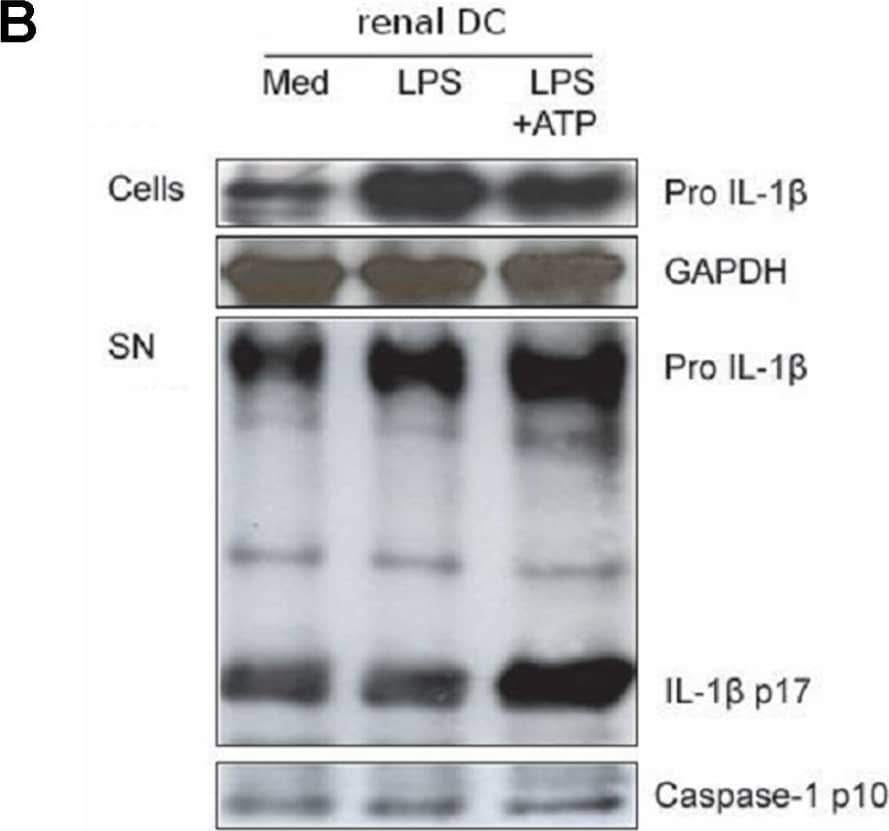 Detection of IL-1 beta/IL-1F2 by Western Blot