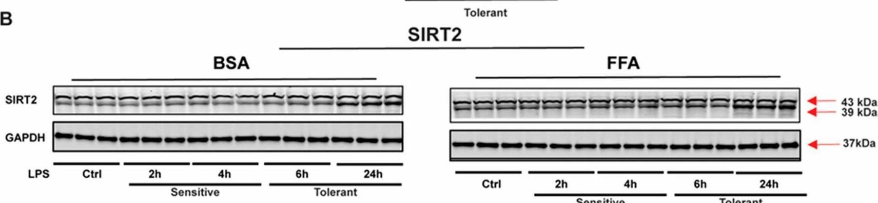 Detection of Sirtuin 2/SIRT2 by Western Blot