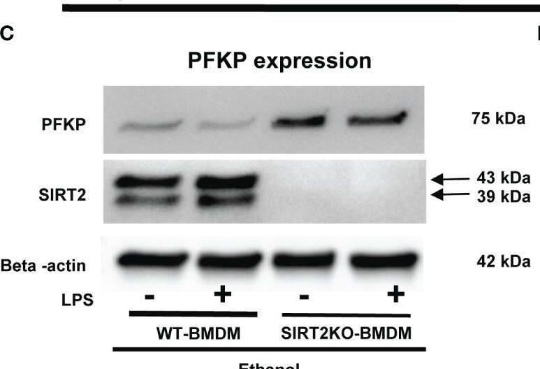 Detection of Sirtuin 2/SIRT2 by Western Blot