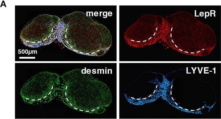 Detection of Mouse Leptin R by Immunohistochemistry