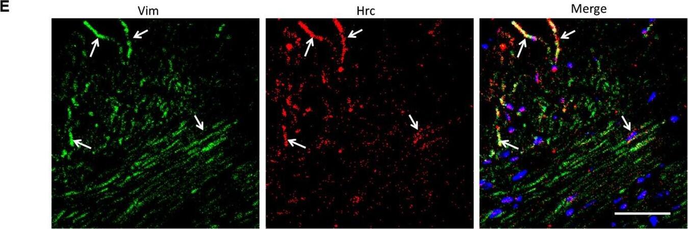 Detection of Mouse Vimentin by Immunohistochemistry