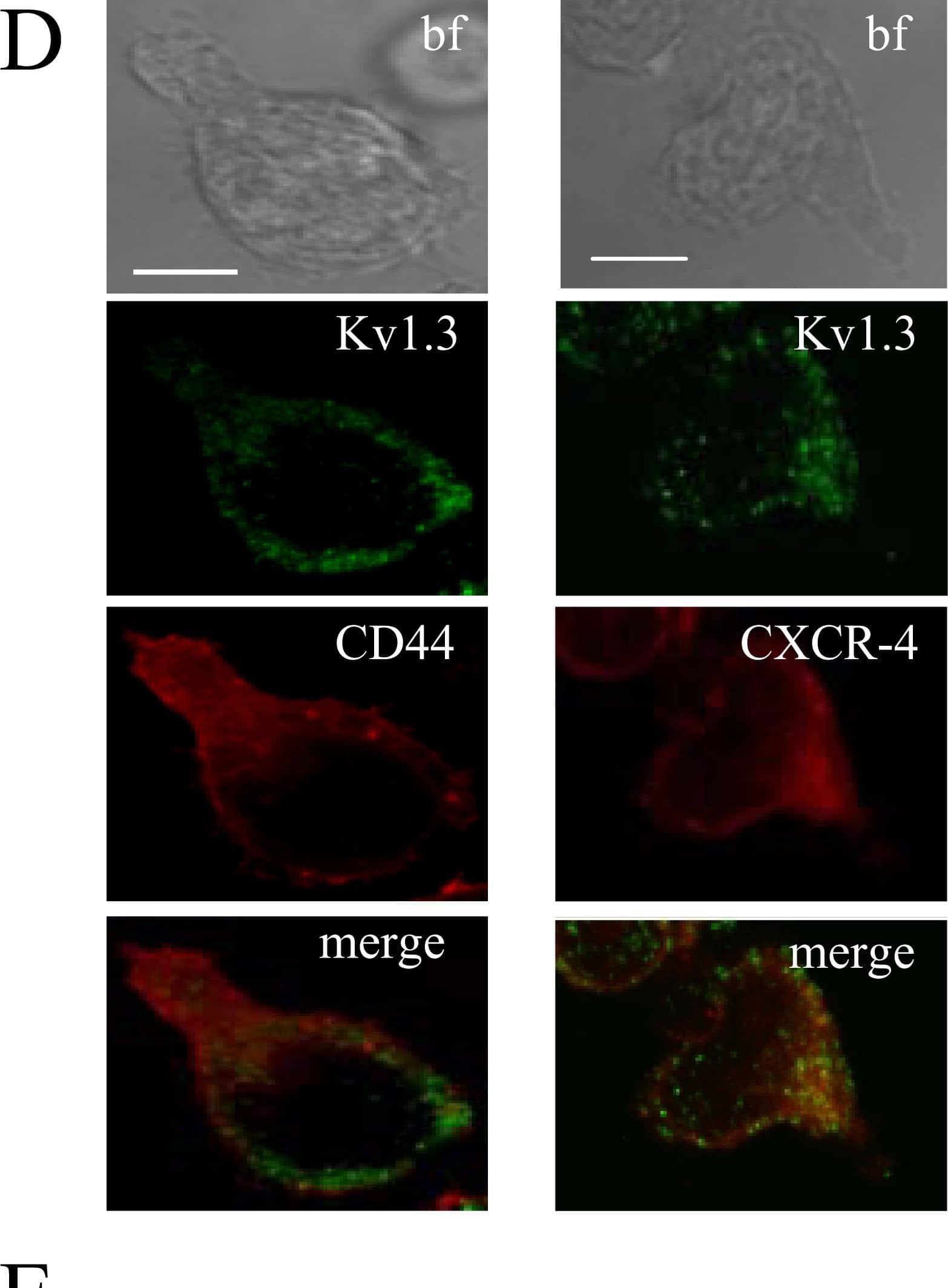 Detection of Human CD44 by Immunocytochemistry/Immunofluorescence