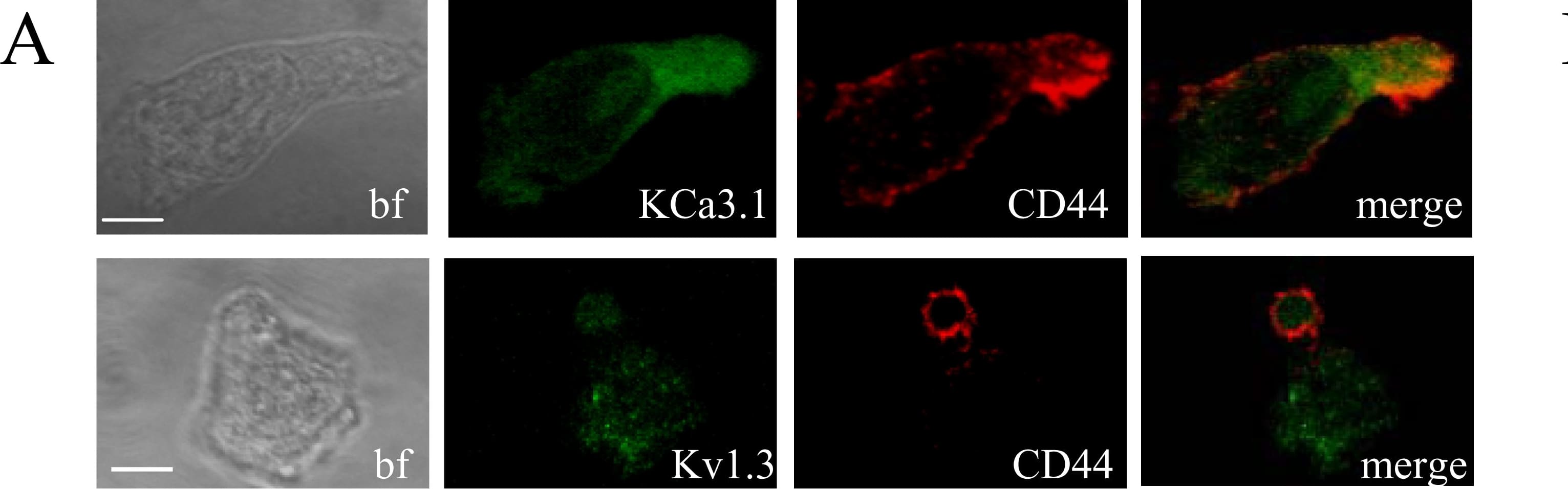 Detection of Human CD44 by Immunocytochemistry/Immunofluorescence