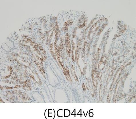 Detection of Human CD44 by Immunohistochemistry