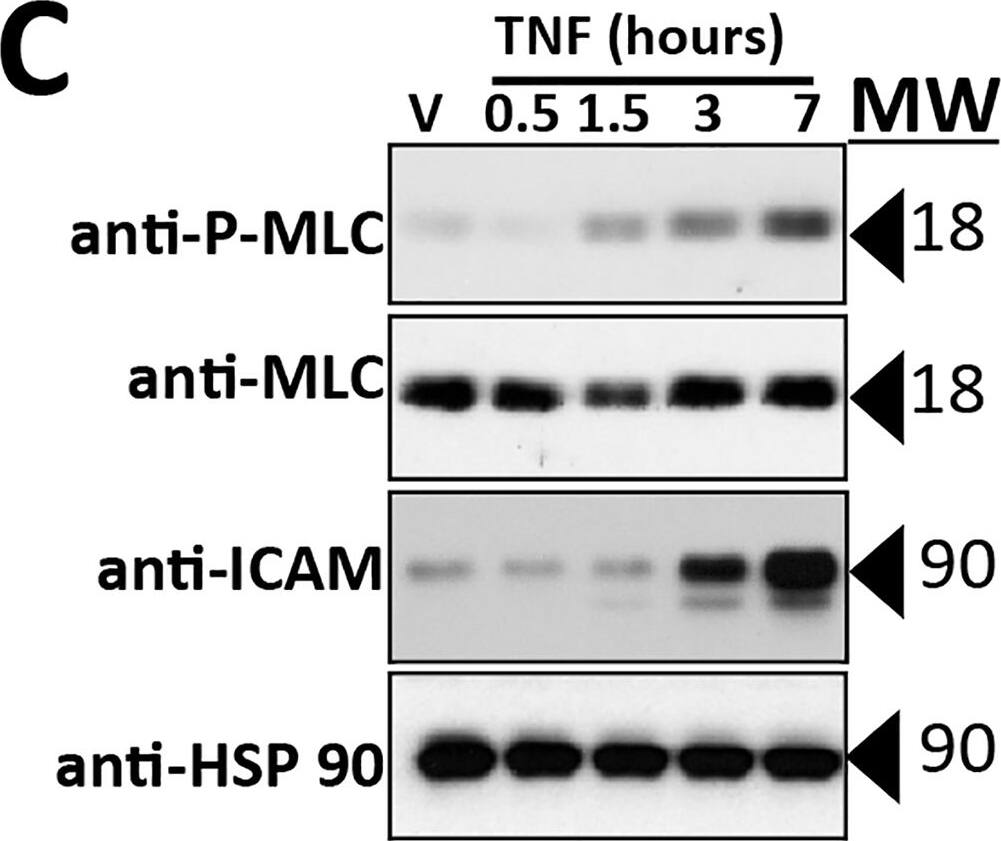 Detection of Human ICAM-1/CD54 by Western Blot