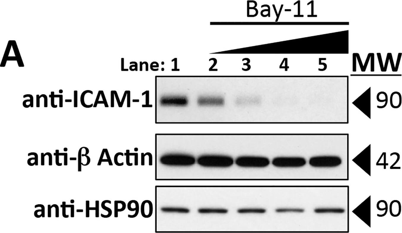 Detection of Human ICAM-1/CD54 by Western Blot