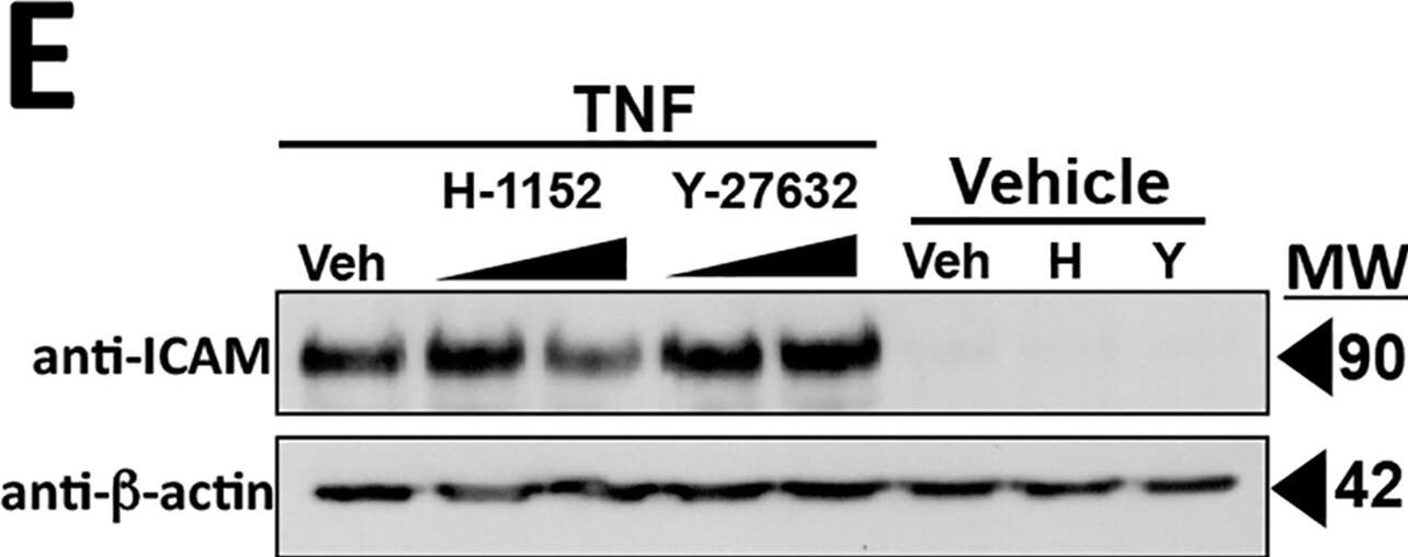Detection of Human ICAM-1/CD54 by Western Blot