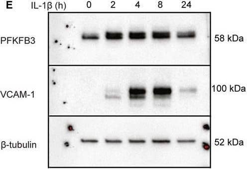 Detection of VCAM-1/CD106 by Western Blot