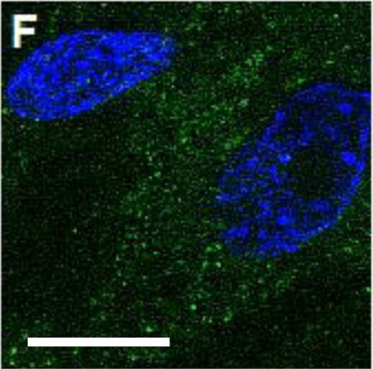 Detection of Human ICAM-1/CD54 by Immunocytochemistry/Immunofluorescence