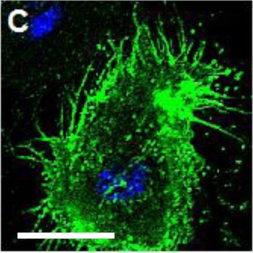 Detection of Human ICAM-1/CD54 by Immunocytochemistry/Immunofluorescence