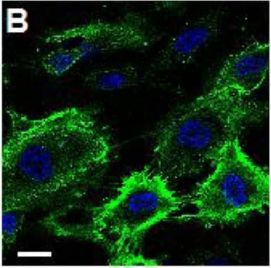 Detection of Human ICAM-1/CD54 by Immunocytochemistry/Immunofluorescence