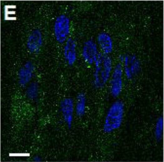 Detection of Human ICAM-1/CD54 by Immunocytochemistry/Immunofluorescence