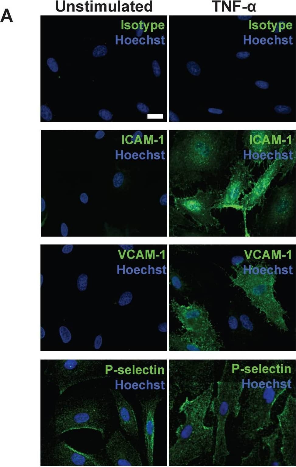 Detection of ICAM-1/CD54 by Immunocytochemistry/ Immunofluorescence