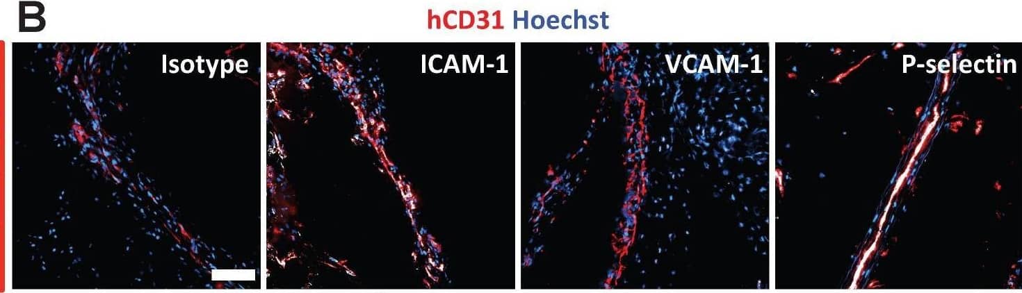 Detection of ICAM-1/CD54 by Immunohistochemistry