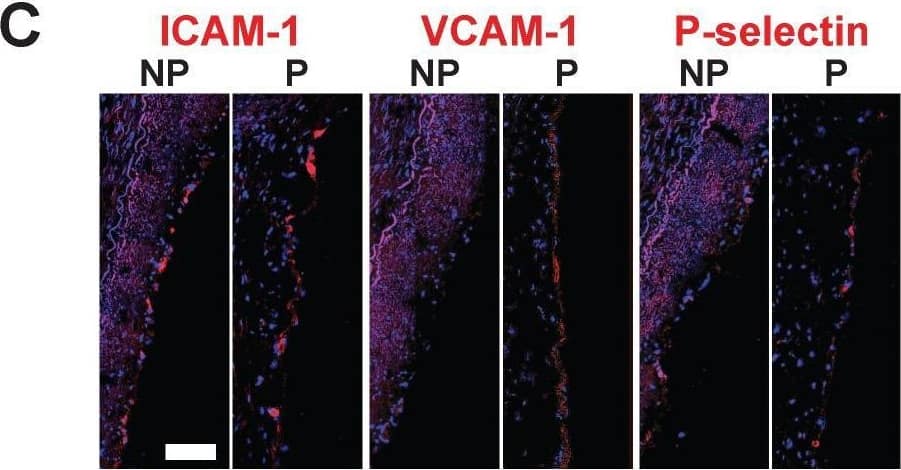 Detection of ICAM-1/CD54 by Immunohistochemistry