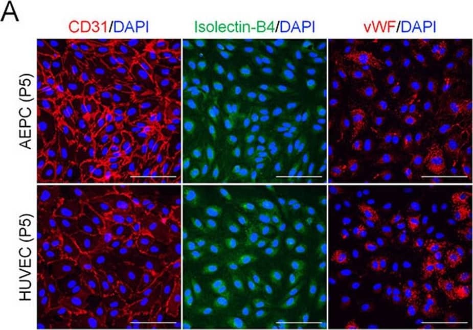 Detection of Human CD31/PECAM-1 by Immunocytochemistry/ Immunofluorescence