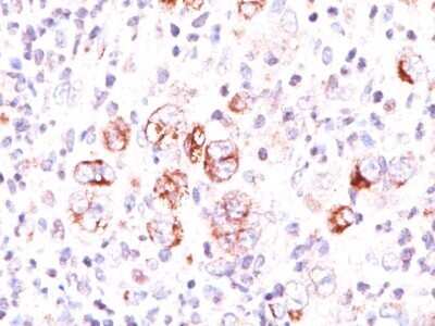 Immunohistochemistry-Paraffin: bcl-x Antibody (2H12) - Azide and BSA Free [NBP2-34531]
