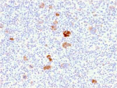 Immunohistochemistry-Paraffin: bcl-x Antibody (BCL2L1/2406) [NBP3-07455]