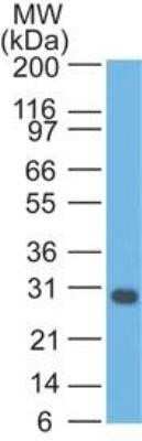 Western Blot: bcl-x Antibody (BX006 + 2H12)Azide and BSA Free [NBP2-34571]