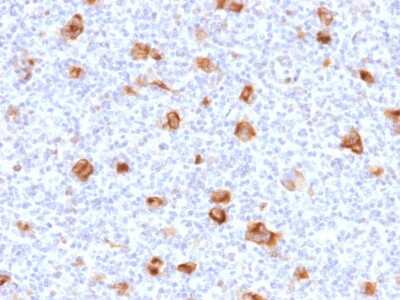 Immunohistochemistry-Paraffin: bcl-x Antibody (SPM519) - Azide and BSA Free [NBP3-08595]