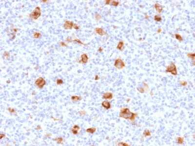 Immunohistochemistry-Paraffin: bcl-x Antibody (SPM519) [NBP3-07417]