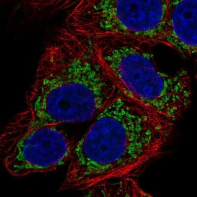 Immunocytochemistry/ Immunofluorescence: bcl10-interacting CARD protein Antibody [NBP2-38125]