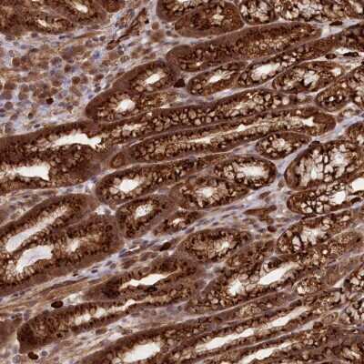 Immunohistochemistry: bcl10-interacting CARD protein Antibody [NBP2-38402]