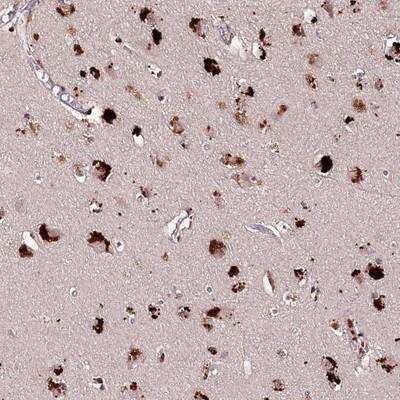 Immunohistochemistry-Paraffin: bcl10-interacting CARD protein Antibody [NBP1-88777]