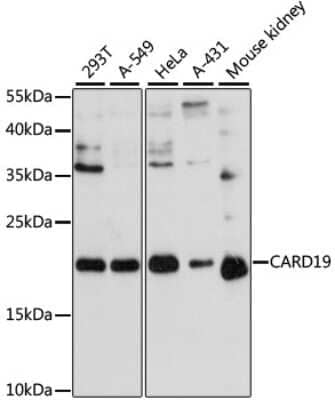 Western Blot: bcl10-interacting CARD protein AntibodyAzide and BSA Free [NBP2-92715]