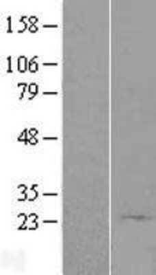 Western Blot: bcl10-interacting CARD protein Overexpression Lysate [NBL1-08606]