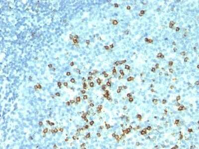 Immunohistochemistry-Paraffin: CD57 Antibody (HNK-1 + NK-1) - Azide and BSA Free [NBP2-47791]