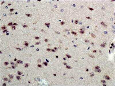 Immunohistochemistry: beta-1,3-Glucuronyltransferase 1/B3GAT1 Antibody - BSA Free [NBP1-19788]